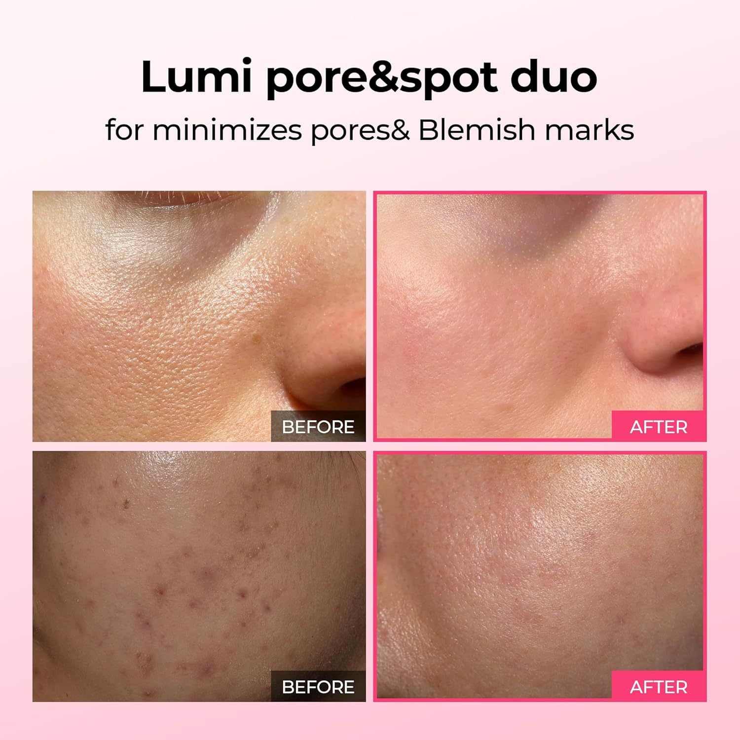 Pink Spicule&Calcium Hydrating Set